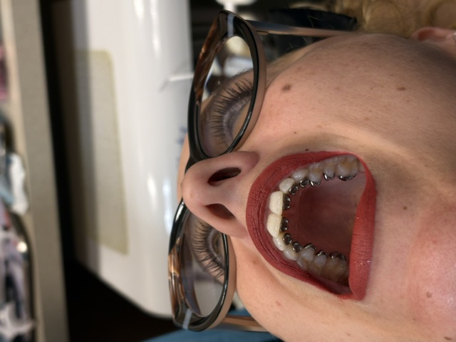 Cool Smilez real patient smile
