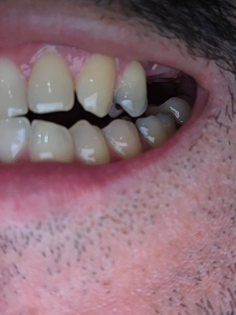 Cool Smilez happy patient
